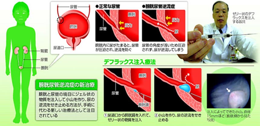 小児外科01