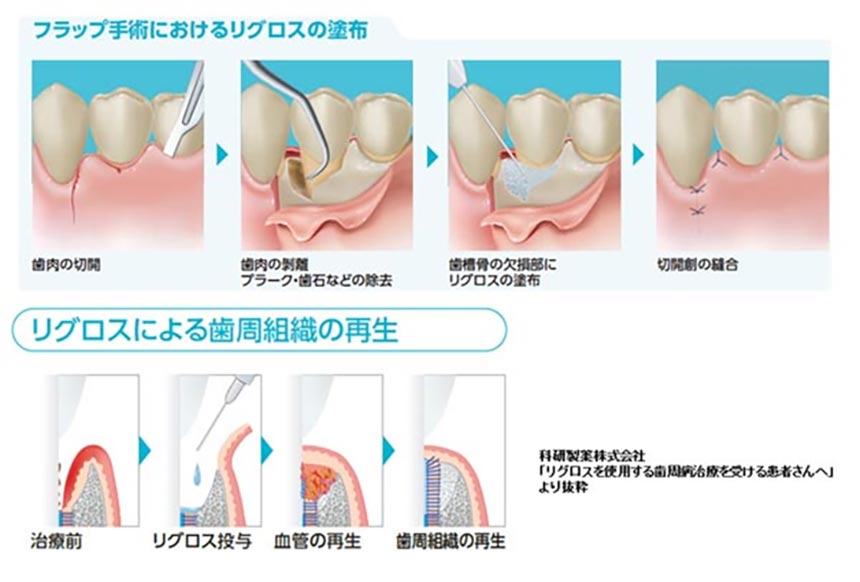 歯周病科02
