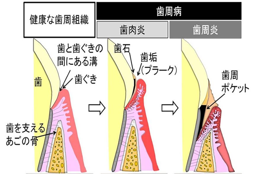 歯周病科01