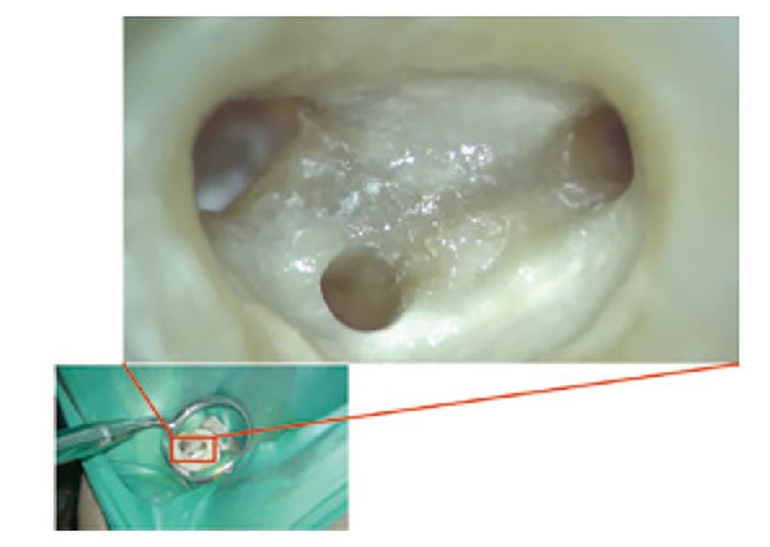 歯内治療科02
