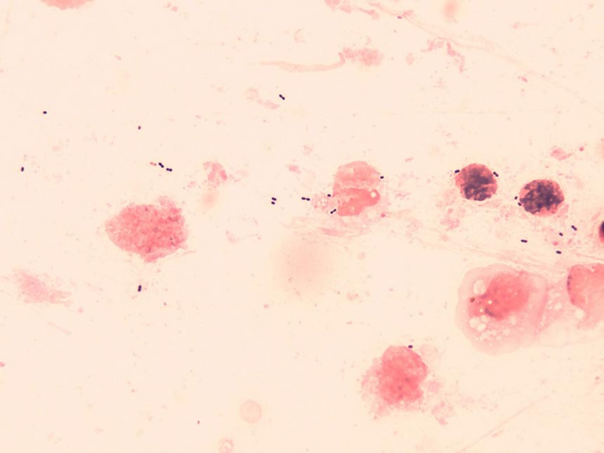 細菌検査室_グラム染色