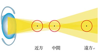 焦点距離（３焦点眼内レンズ）