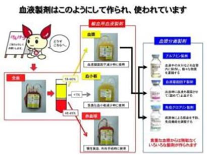 輸血の種類1